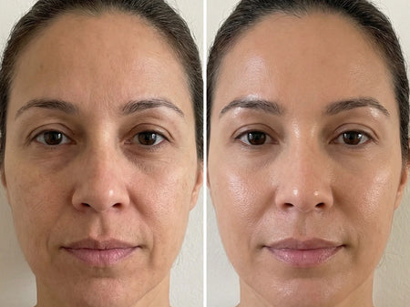 before and after