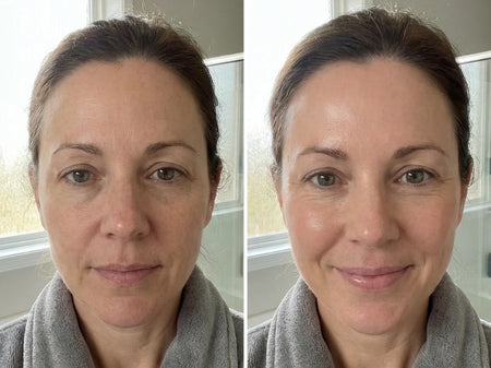 before and after