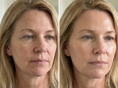 before and after