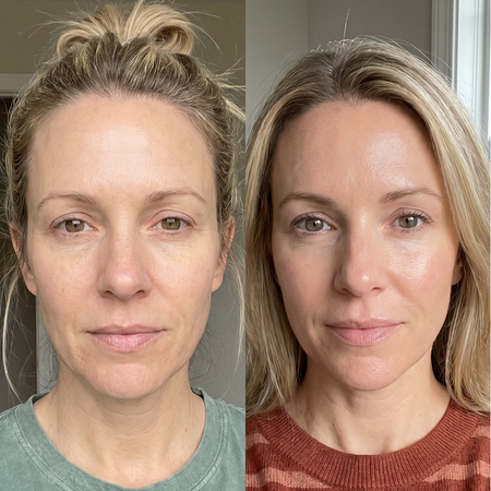before and after