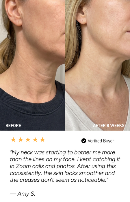 before and after