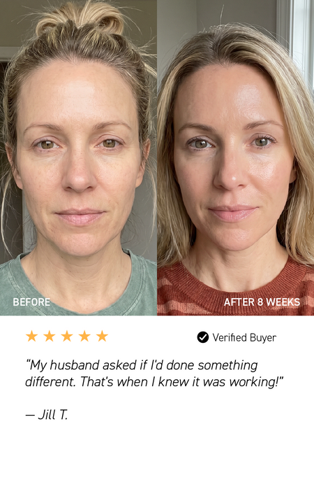 before and after