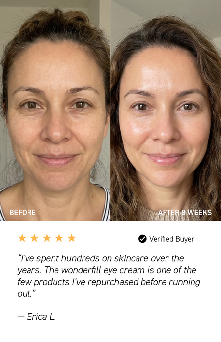 before and after